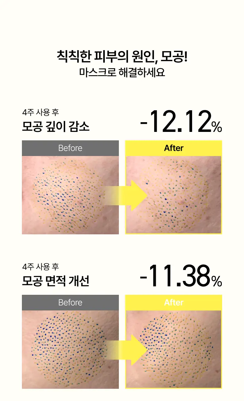 [올영단독] 아누아 데일리케어 마스크팩 5매 기획 8종(+1매 추가 증정) 상세페이지 107